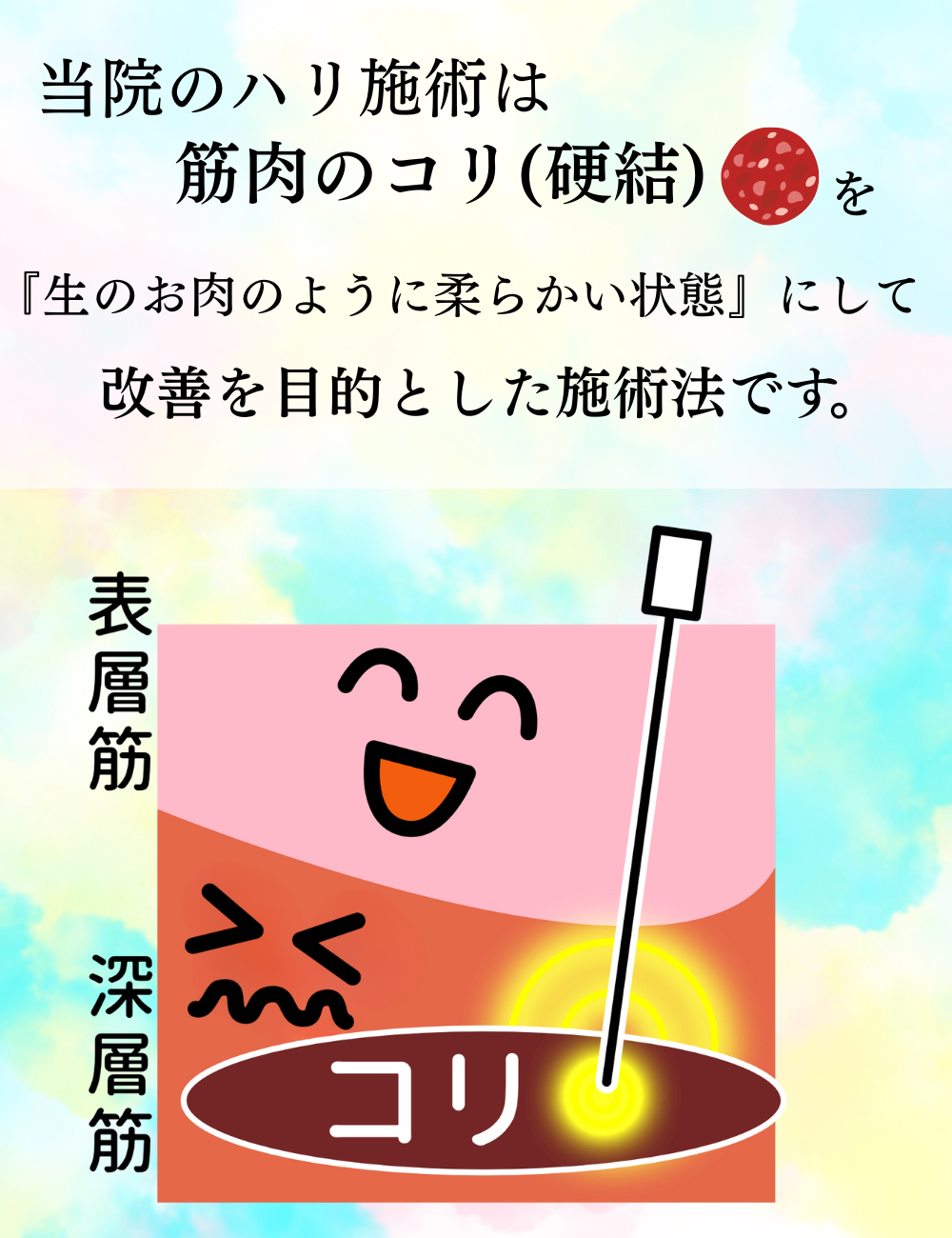 当院のハリ施術は、筋肉のコリ(硬結)を「生のお肉のように柔らかい状態」にして改善を目的とした施術法です。