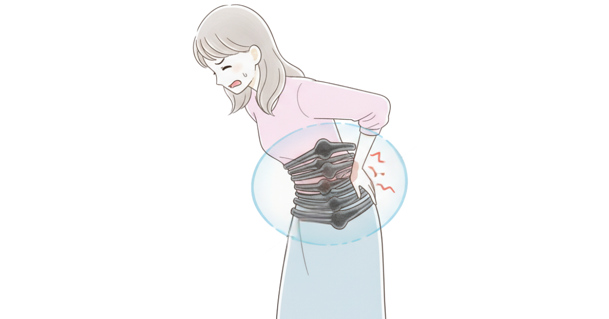 痛みをかばって腰周囲の筋が緊張する