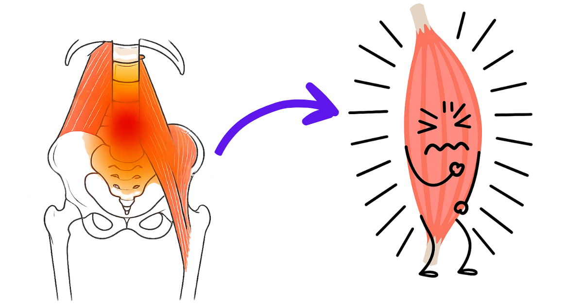 防御反応:腰まわりの筋肉がガチガチに緊張する様子の図解