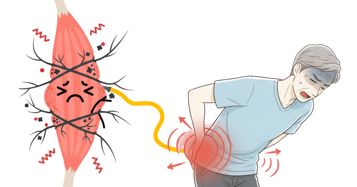 緊張で硬くなった筋肉に血管が圧迫され、新鮮な酸素が届かず、痛みを生む物質が澱のように溜まっていく様子の図解
