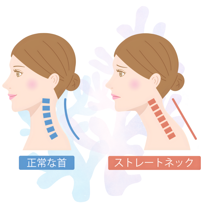 ストレートネックで悩んでいる女性のイメージ画像